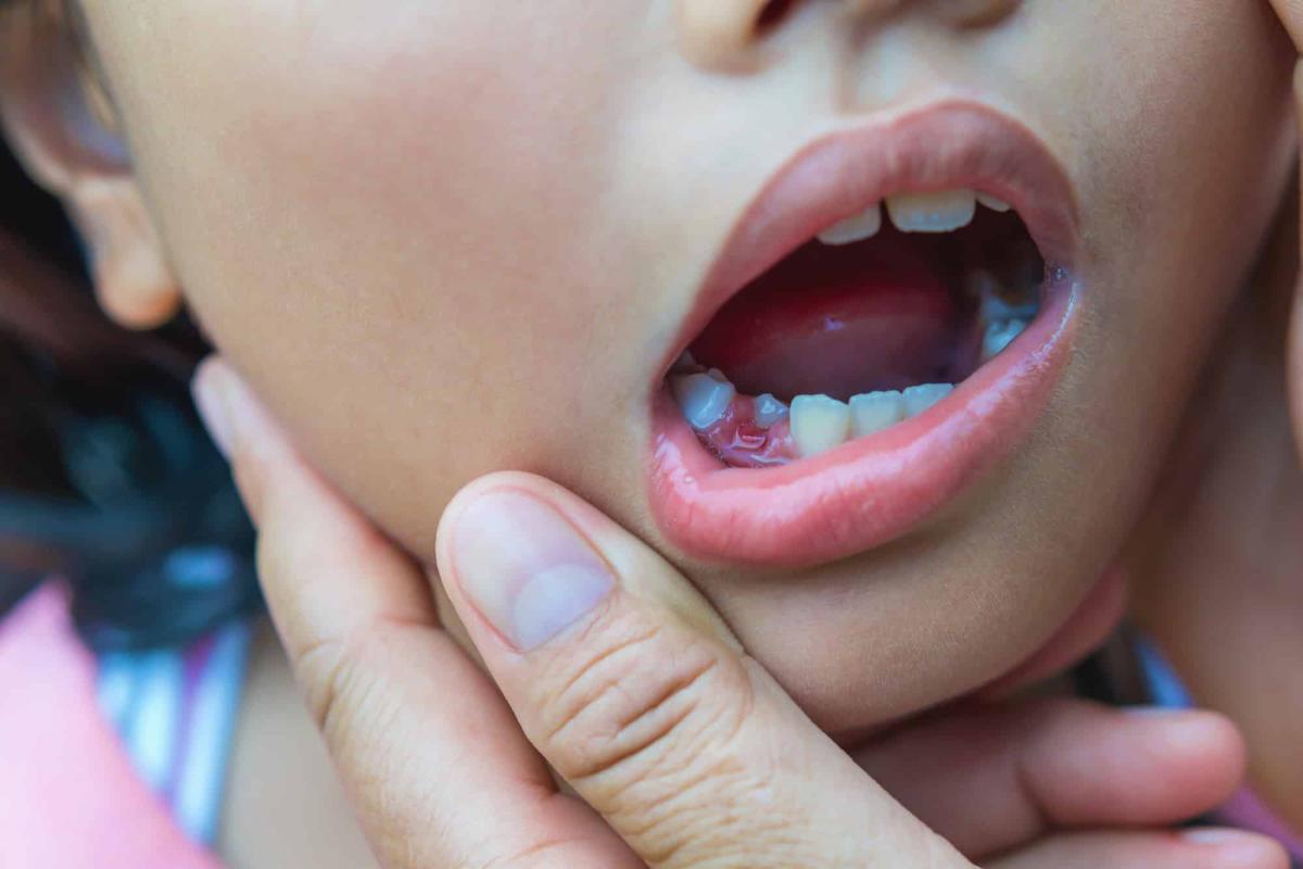 baby-teeth-not-falling-out.jpeg